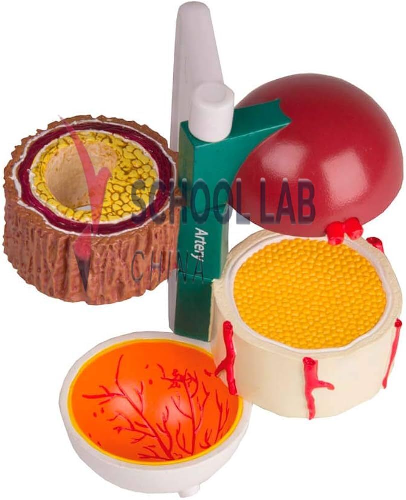 Diabetes Model: 4-Piece